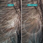 Pilgrim Australian Tea Tree Non-Drying Anti-Dandruff Shampoo 200 ml | Removes Dandruff from Source | Helps with Itching, Irritation | Strong & Smooth Hair | For Men & Women | - Image 5