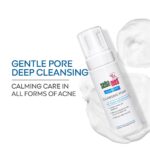 Sebamed Clear Face Cleansing Foam for Acne prone Skin 150 ml I pH 5.5 I Gentle, Effective hydrating cleanser for pimples | Face wash |men & womenl Oil Free l Clinically proven l Toxin free - Image 3