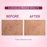 Pond's Bright Beauty Light Cream with UV Filter | Niasorcinol | 100x Better than Vitamin C | Niacinamide | Fades Dark Spots, Brightens Skin, 35g - Image 4