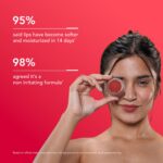 Bella Vita Organic NicoLips Lip Balm & Lip Scrub | Lip Balm for Dark Lips | Anti Pigmentation for Dry, Chapped Lips | Removes Lipstick Stains | Lip Care for Men & Women | 20g - Image 3