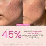 O3+ Night Repair Cream Brightening & Glow Boosting Dermal Zone (50gm) - Image 6