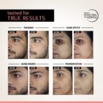 Deconstruct 5% Niacinamide Serum + 2% Alpha Arbutin Clearing Serum| Clinically Tested| Reduces Dark Spots, Pigmentation, Acne Marks & Tanning |4-in-1 Multi-Benefit |Non-Irritating |30ml - Image 5