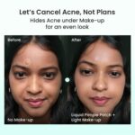 Liquid Pimple Patch | Invisible Spot Treatment & Concealer Base | Upto 4 Hours Seamless Hiding Under Makeup | Heals & Protects Blemishes - 10ml - Image 3