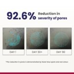 RE' EQUIL 0.3% Retinol Night Cream, Improves Skin Texture, Reduces Acne, Unisex, For All Skin Types, 30G - Image 6