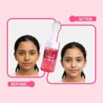 Whimsy Beauty Foaming Face Wash for Kids | Gentle Daily Cleanser with Aloe Vera, Strawberry and Vitamin B3 | Tear Free, Non Drying | Dermatologist Tested | Safe for Sensitive Skin | 4 to16 Years | 100 ml - Image 4