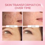 RENEE Pink Therapy PDRN Pink Peptide Face Serum For Glowing, Radiant Skin | Hydrates, Boosts Collagen, Evens Skin Tone | Lightweight, Quick Absorbing | Hyaluronic Acid & Niacinamide Infused | 30 ml - Image 6