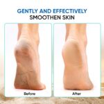 VEGA 4 in 1 Feet Pedicure Tools with Foot Scrubber, Pumice Stone, Foot Rasp and Black Emery for Home Foot Care, Soft Care | Foot File Callus Remover - Multi Purpose Pedicure & Manicure Tool, (PD-02) - Image 10