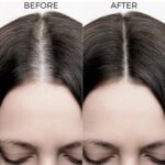 Brillare 20% Rosemary Oil Shots For Rapid Hair Growth | Improves Thickness | Controls Hair Fall & Nourishes Scalp | 100% Natural, Non Greasy Hair Oil Shots For Men & Women - Image 4