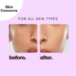 Prismos Beauty Pearlsoft Moisturizer 75ml | With Niacinamide, Tea Tree Oil & Pine Bark Extract | Lightweight, Non-Greasy Hydrating Gel for Smooth, Glowing Skin | Suitable for All Skin Types - Image 3