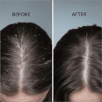 Beauty Garage ScalpSense Dandruff defense Shampoo 200ml - Image 5