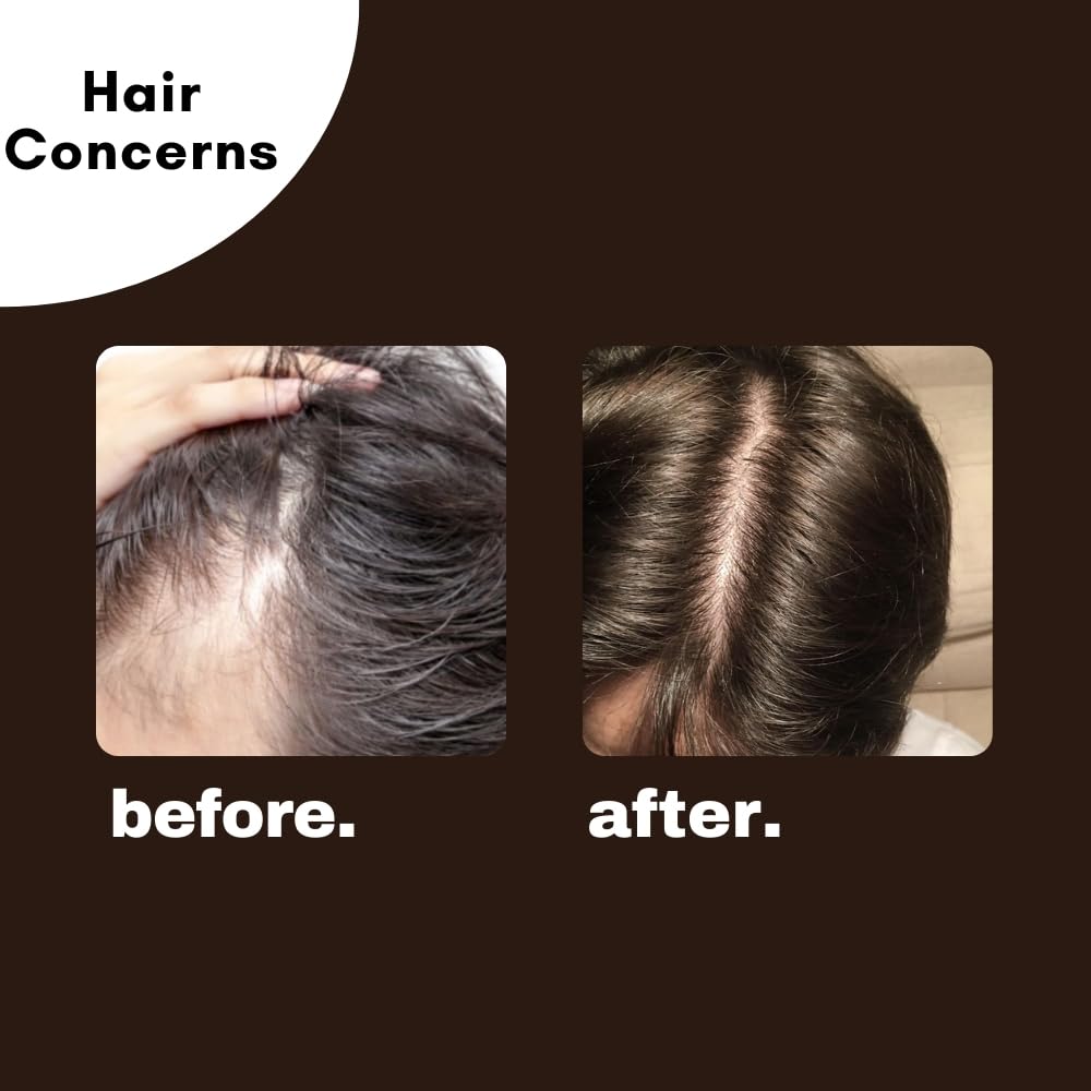 Prismos Beauty Fallcure Hair Oil For Winter 100ml | Bhringraj, Amla & Hibiscus Scalp Oil for Hair Growth | Anti Hair Fall Solution | Non-Sticky Oil for Men & Women | Suitable for All Hair Types - Image 5