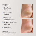 Cureskin Foot Care Cream for Cracked Heels | Repairs, Softens, and Exfoliates | Foot Cream for Women and Men, 50 g (Pack of 1) - Image 5