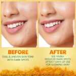 Himalaya Dark Spot Clearing Turmeric Face Serum for glowing skin | with Niacinamide, Glycolic acid & Organically sourced Turmeric | Reduces Dark Spots from Day 7 for Glowing skin | 15ml - Image 9