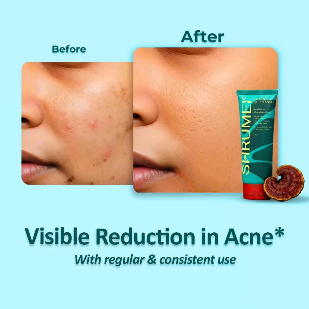 Calming Gel Cleanser 100% Natural, Hydrating + Barrier Support Formula for Normal Skin Type Face Wash - Image 5