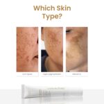 Personal Touch Melakey Radiance Cream for Hyperpigmentation & Melasma | 5% Azelaic Acid | Dark Spot Corrector with Glycolic Acid & Niacinamide for Even Skin Tone | 20gm - Image 6