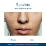 Blue Nectar Rice Water Kojic Acid Face Serum for Pigmentation & Dark Spots Removal | Anti Pigmentation Serum for Face with Mushroom (13 Herbs, 30ml) - Image 6