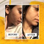 RAS Luxury Oils 24K Gold Radiance Elixir Face Serum for Glowing Skin, Skin Brightening, Reduce Wrinkles, Acne, Dark Spots, Natural & Organic - Image 8