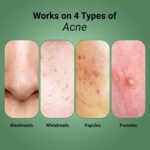 Sereko Clear Corrective Serum with 2% Encapsulated Salicylic Acid BHA & 3% Azelaic Acid | Active Acne | Reducing Sebum Production | Pigmentation & Dark Spots for Oily | Acne-Prone Skin 30ml - Pack 1 - Image 4