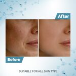 Raaga Professional DeTan Tan Removal Cream | Kojic & Milk | Reduces Tan, Dark Spots & Dullness | Dermatologically Tested, Peroxide & Sulphate Free - 72 g (12 g × 6) - Image 7