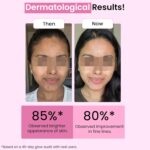 Dr. Su Exosome Anti-Ageing Serum | Hydrating, Firming & Plumping | With Hyaluronic Acid & Copper Peptide | Boosts Collagen | Reduces Wrinkles & Fine Lines | 30ml - Image 7