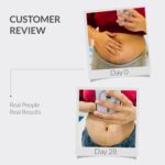 AreoVeda Stretch Marks Removal Cream (50g) | Targets Stubborn Old & New Stretch Marks | Powered With Striover & CryoCoffee | Non-Sticky, Fast Absorbing | Pregnancy & Breastfeeding Safe - Image 3