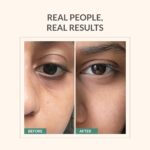 AreoVeda Under Eye Cream with Cooling Massage Roller | Under Eye Roll On with Quinoa for Dark Circles, Puffiness & Fine Lines | Pregnancy-Safe | 10 ml - Image 4