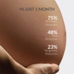 AreoVeda Stretch Marks Removal Cream (50g) | Targets Stubborn Old & New Stretch Marks | Powered With Striover & CryoCoffee | Non-Sticky, Fast Absorbing | Pregnancy & Breastfeeding Safe - Image 2