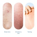 Be Bodywise 10% Lactic AHA Exfoliating Body Scrub 200g | Tan Removal & Soft-Smooth Skin | De-Tan Bathing Scrub with Centella Water & Aloe Vera, Removes Dirt & Dead Skin from Neck, Knees, Elbows & Arms | All Skin Types - Image 2