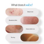 Be Bodywise 5% AHA BHA Exfoliating Body Wash 250ml | For Body Acne, Strawberry Skin, De-Tan | Infused with 3% Lactic Acid, 1% Salicylic Acid, 1% Glycolic Acid | Non-Drying, Paraben Free - Image 2