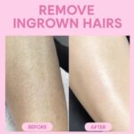 Cyperus Rotundus Natural Body Hair Reduction Oil, Slows Regrowth, Moisturising, Suitable for All Skin Types, 30ml (1, 30, millilitre) - Image 2