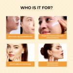 Dr. Sakhiya’s Acne & Pimple Sunscreen SPF 50 (50gm) for Oily & Acne-Prone Skin | Zinc Oxide + Niacinamide + Hyaluronic Acid | Oil-Free, No White Cast, Water Resistant | Dermatologist Tested - Image 2