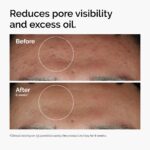 The Ordinary Niacinamide 10% + Zinc 1%, Brightening & Smoothing Serum for Blemish-Prone Skin - Image 2